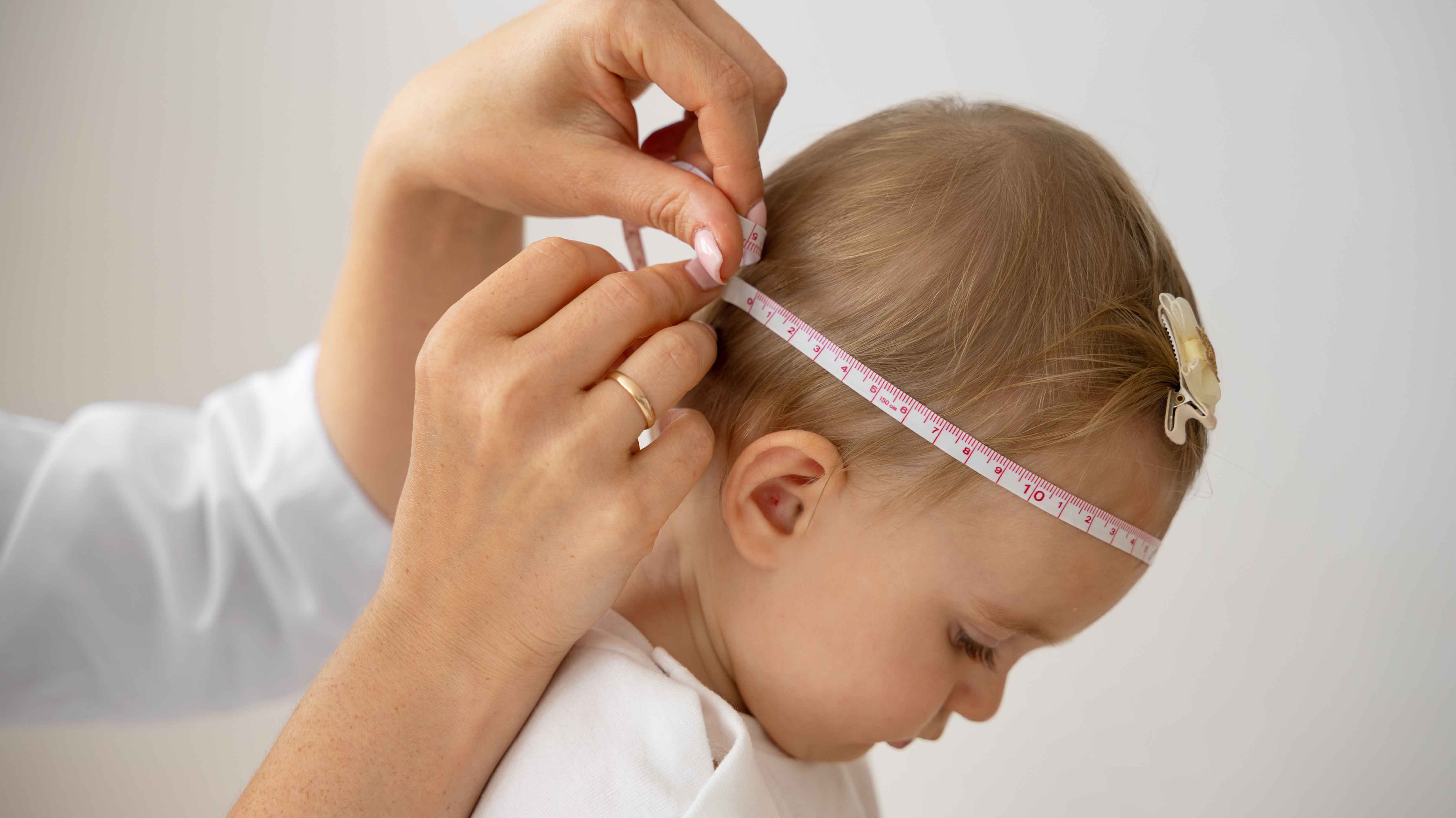 Özgür Taşkapılıoğlu Craniosynostosis Surgery
