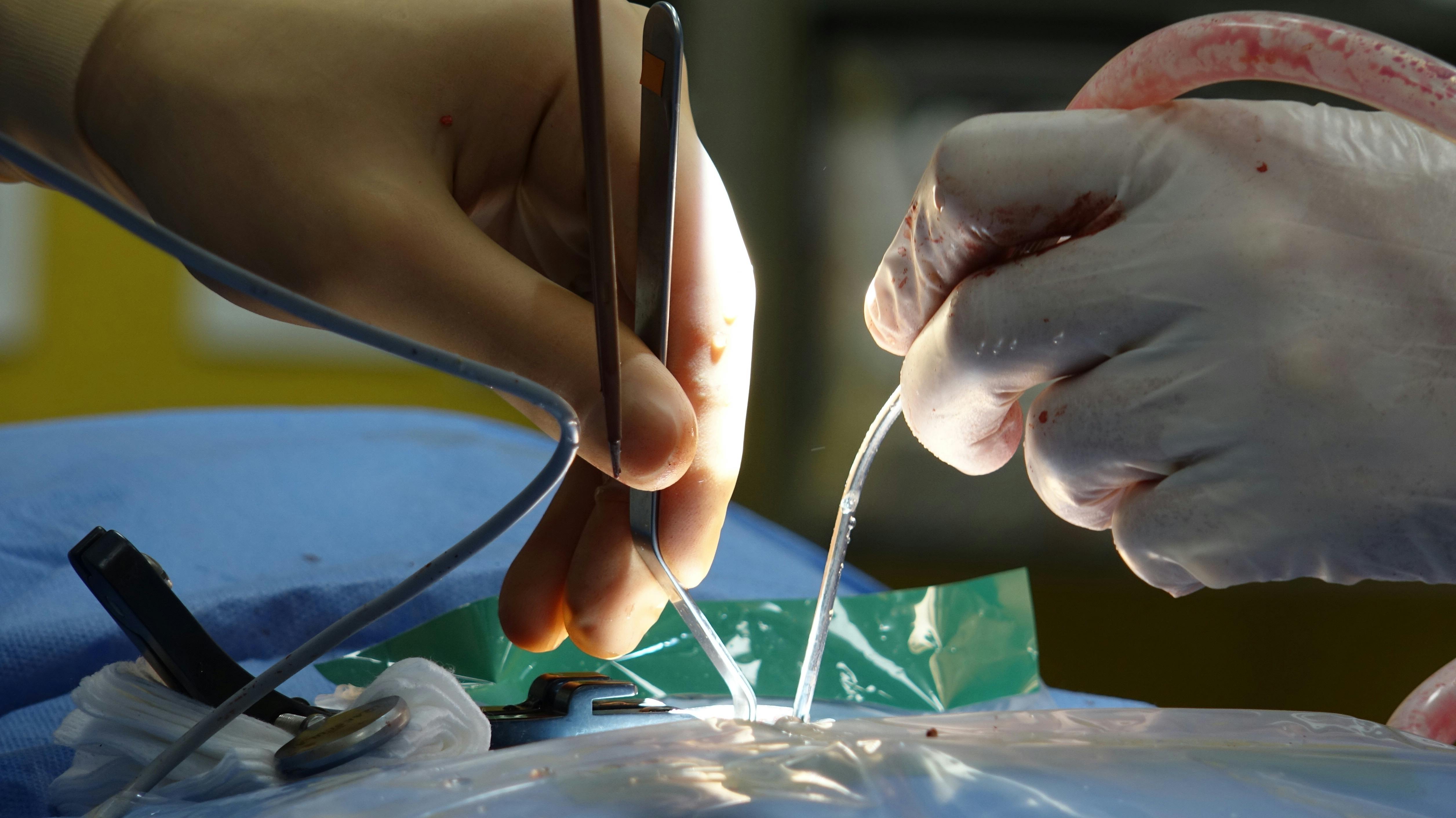 Özgür Taşkapılıoğlu brain surgery